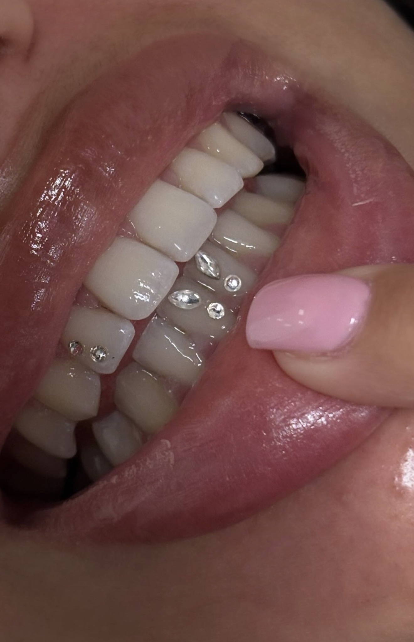 Meerdere tooth gems naast elkaar