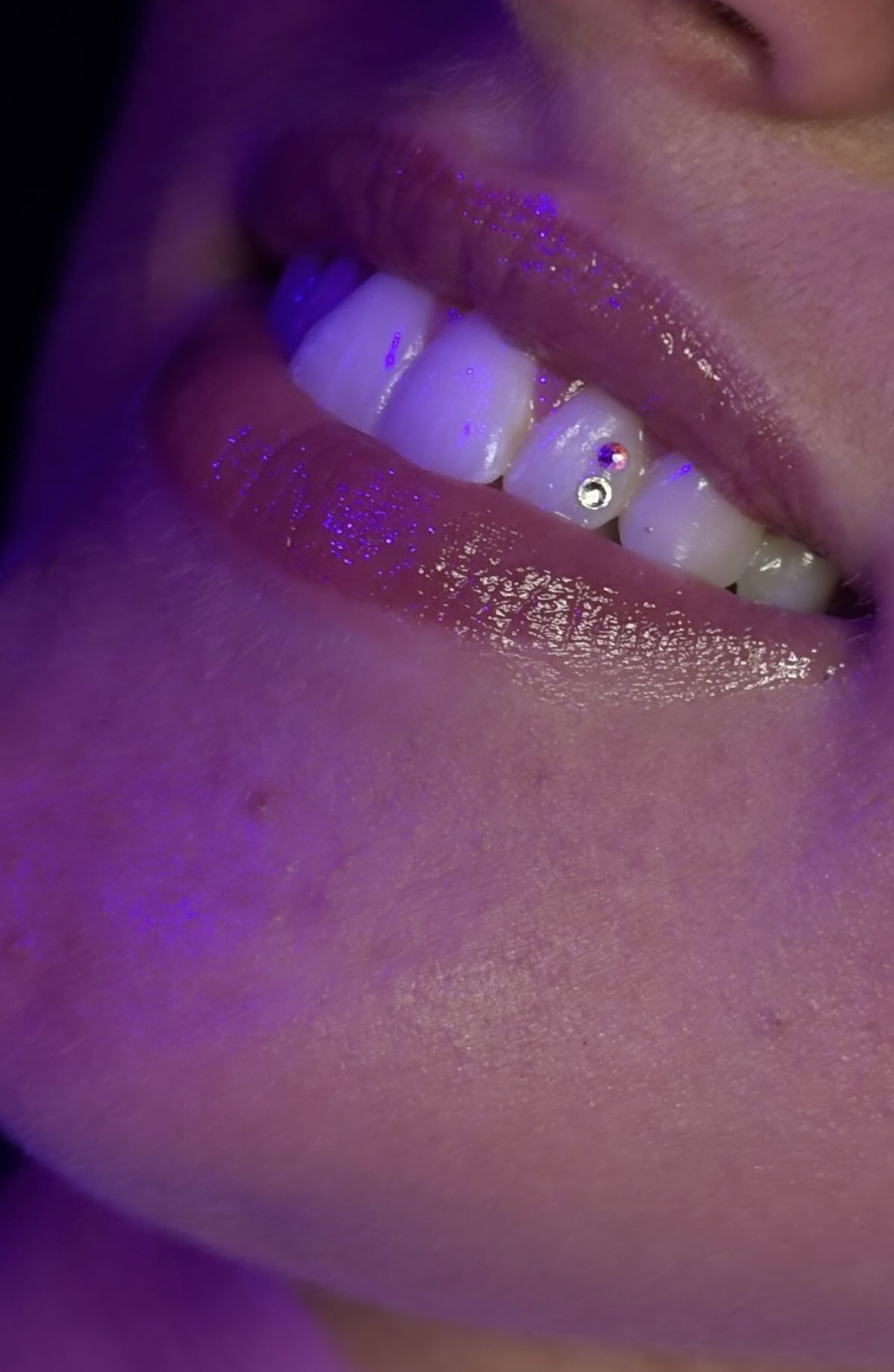 Tooth gem detail close-up